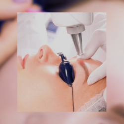 Tratamientos especiales Eliminación tatuajes y eliminación de micropigmentación Eliminación pigmentación de cejas centro estética Valencia eliminacion tatuajes